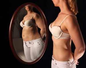 Anoressia nervosa
