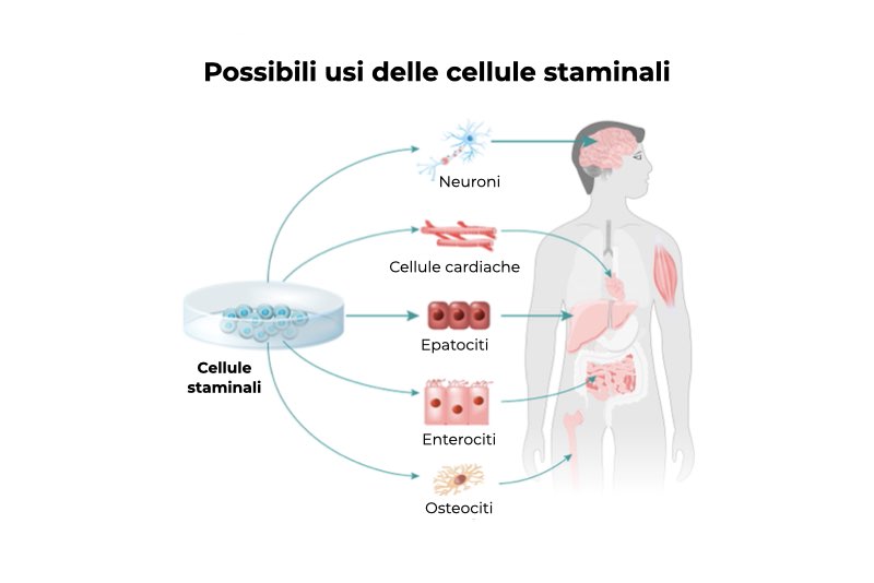 Autotrapianto cellule staminali