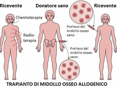 Compatibilità midollo osseo